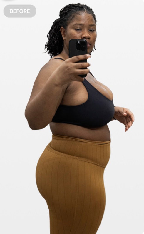 Side view of a woman before taking Gotrim Slim