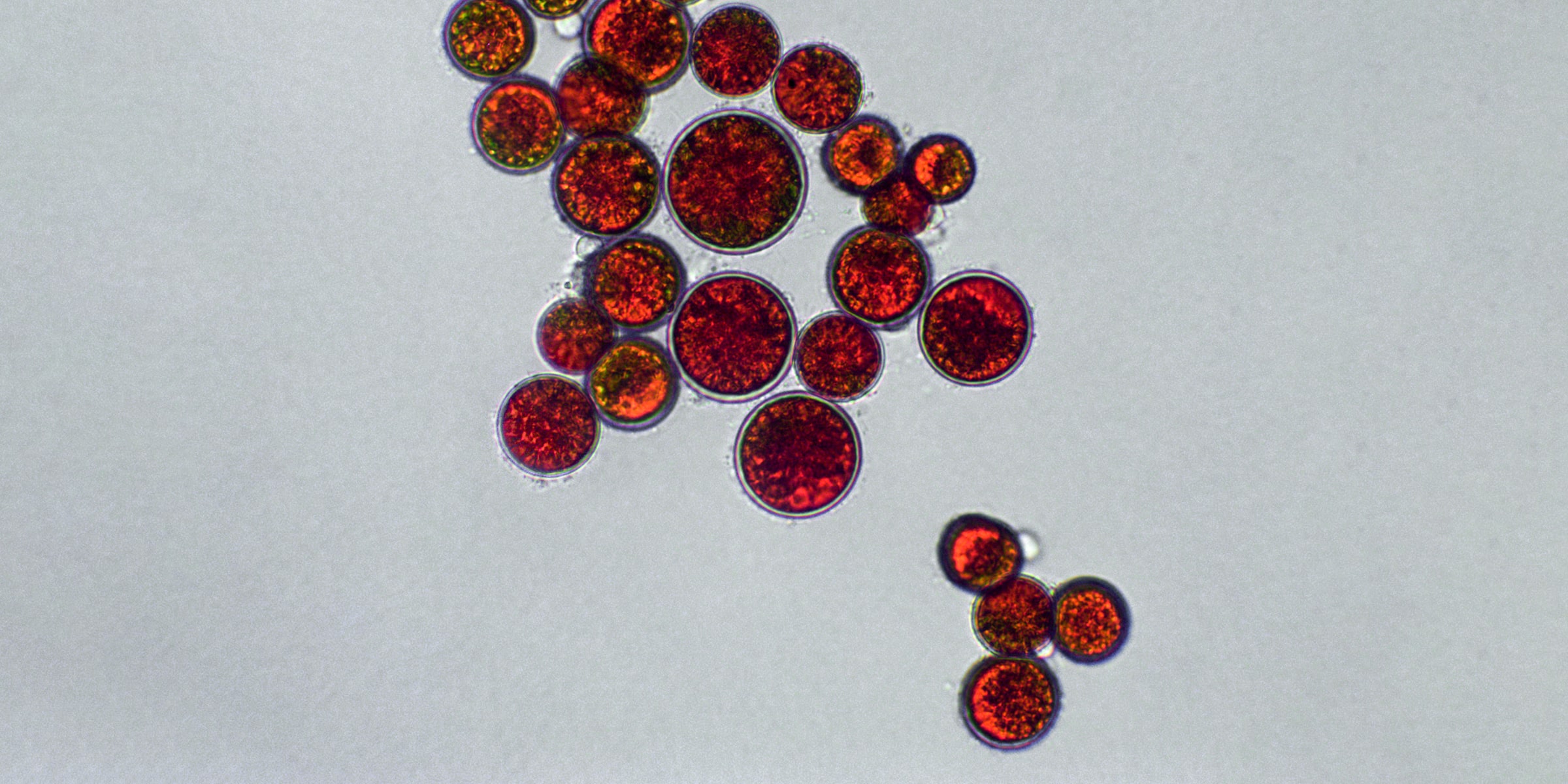 image of microscopic astaxanthin