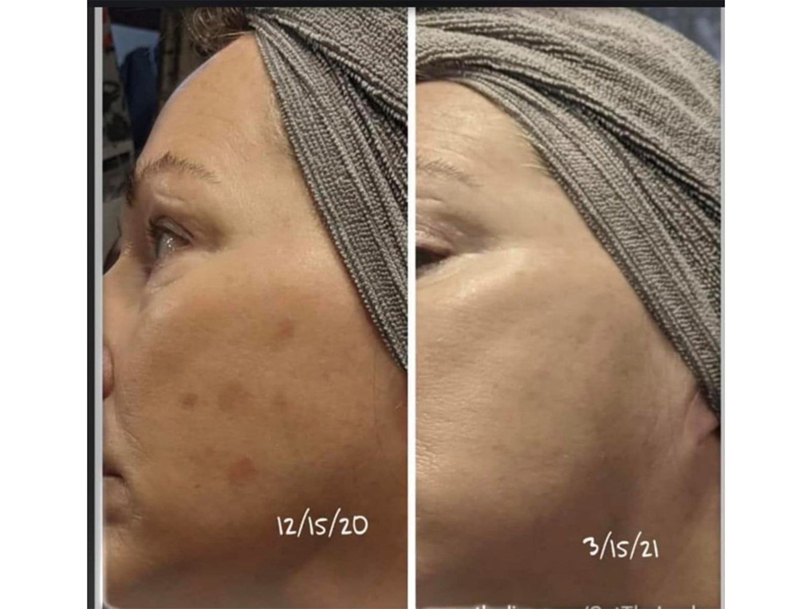 Side by side of woman's face