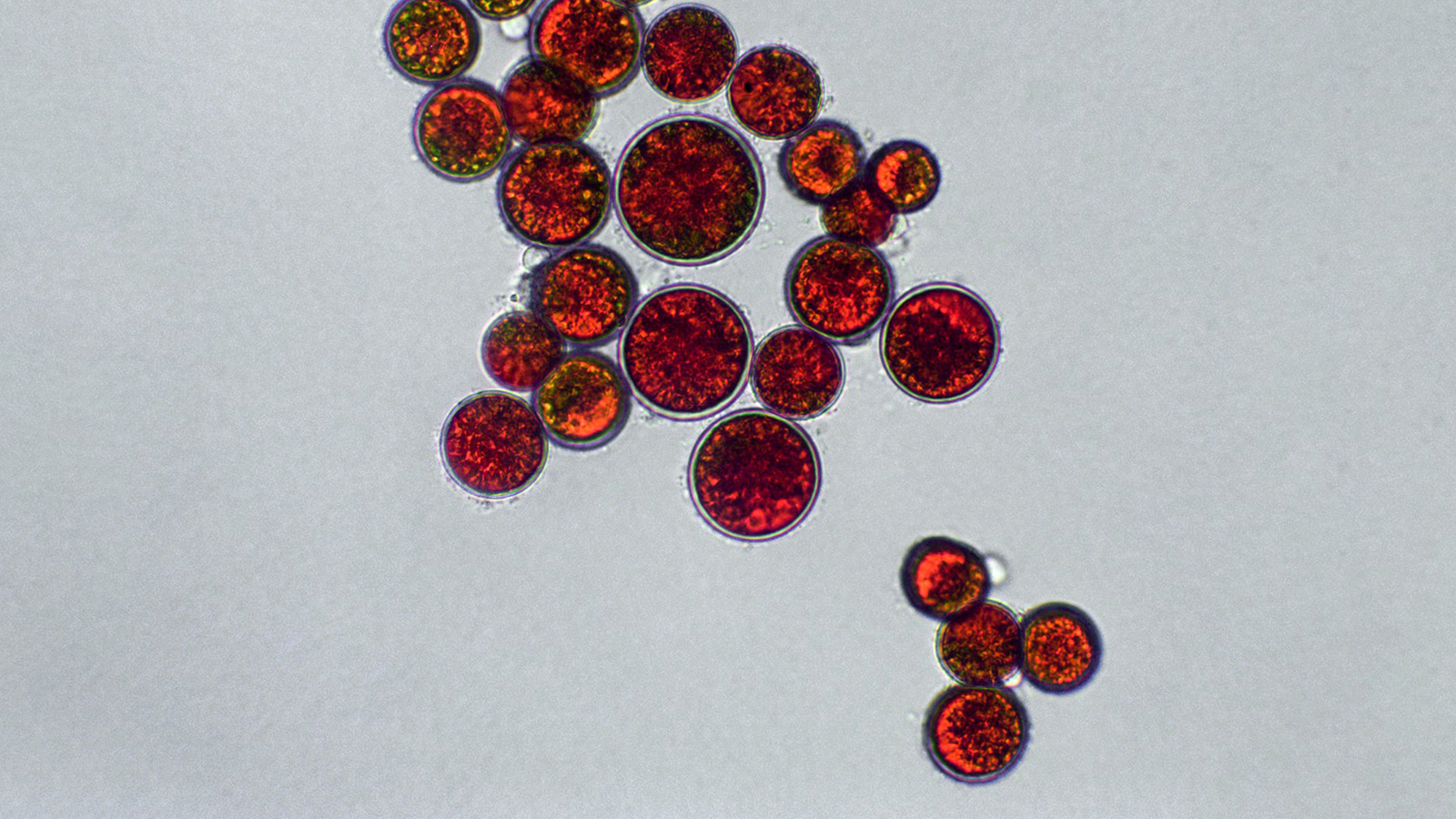 image of microscopic astaxanthin