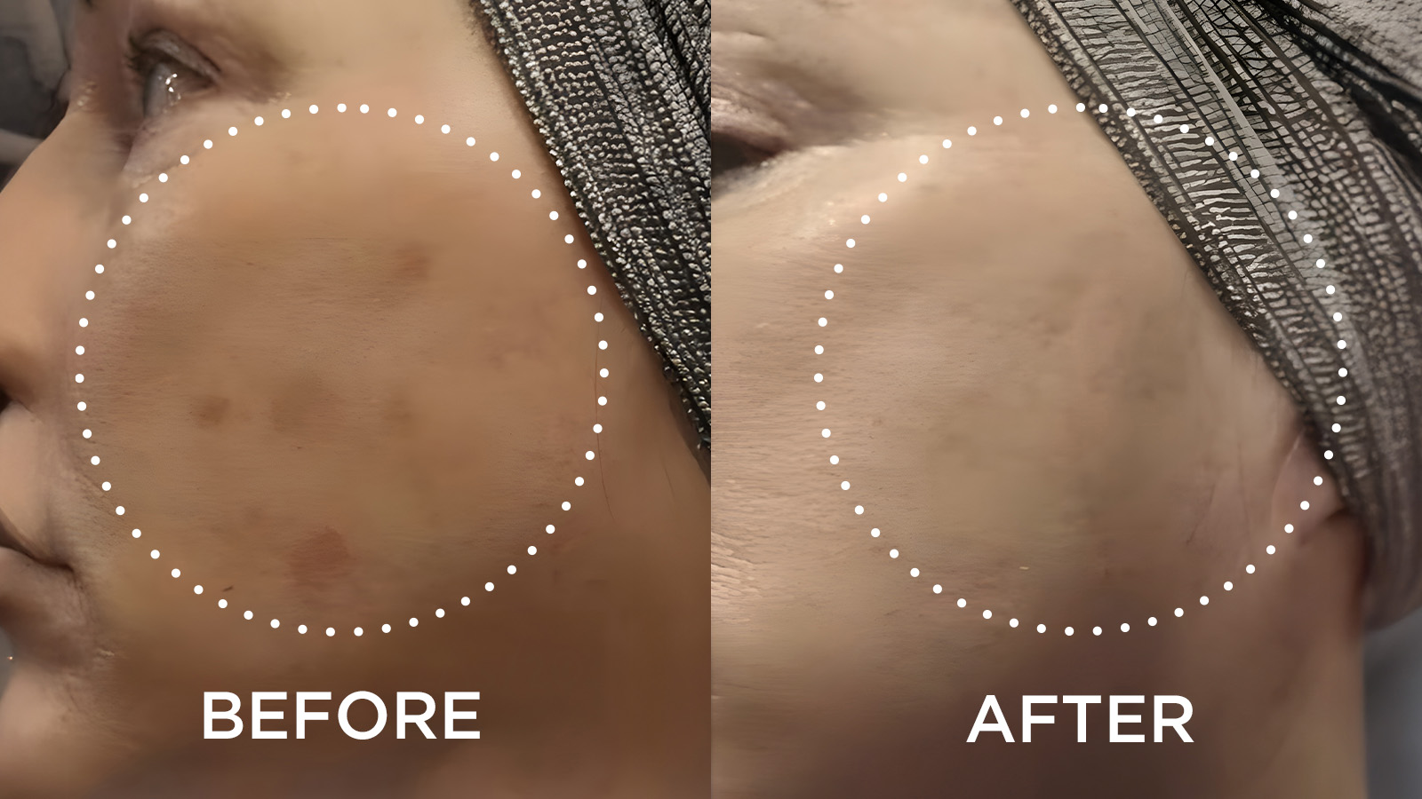 Side by side of woman's face