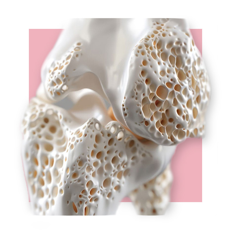 image of bones
