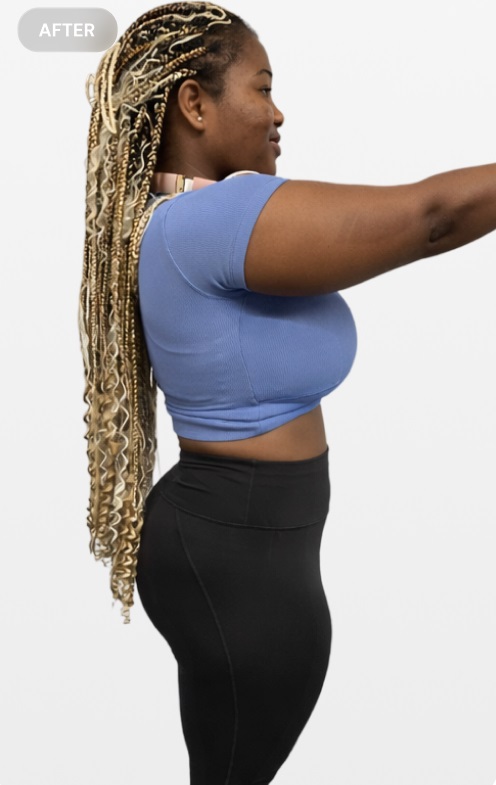 Side view of a woman after taking Gotrim Slim