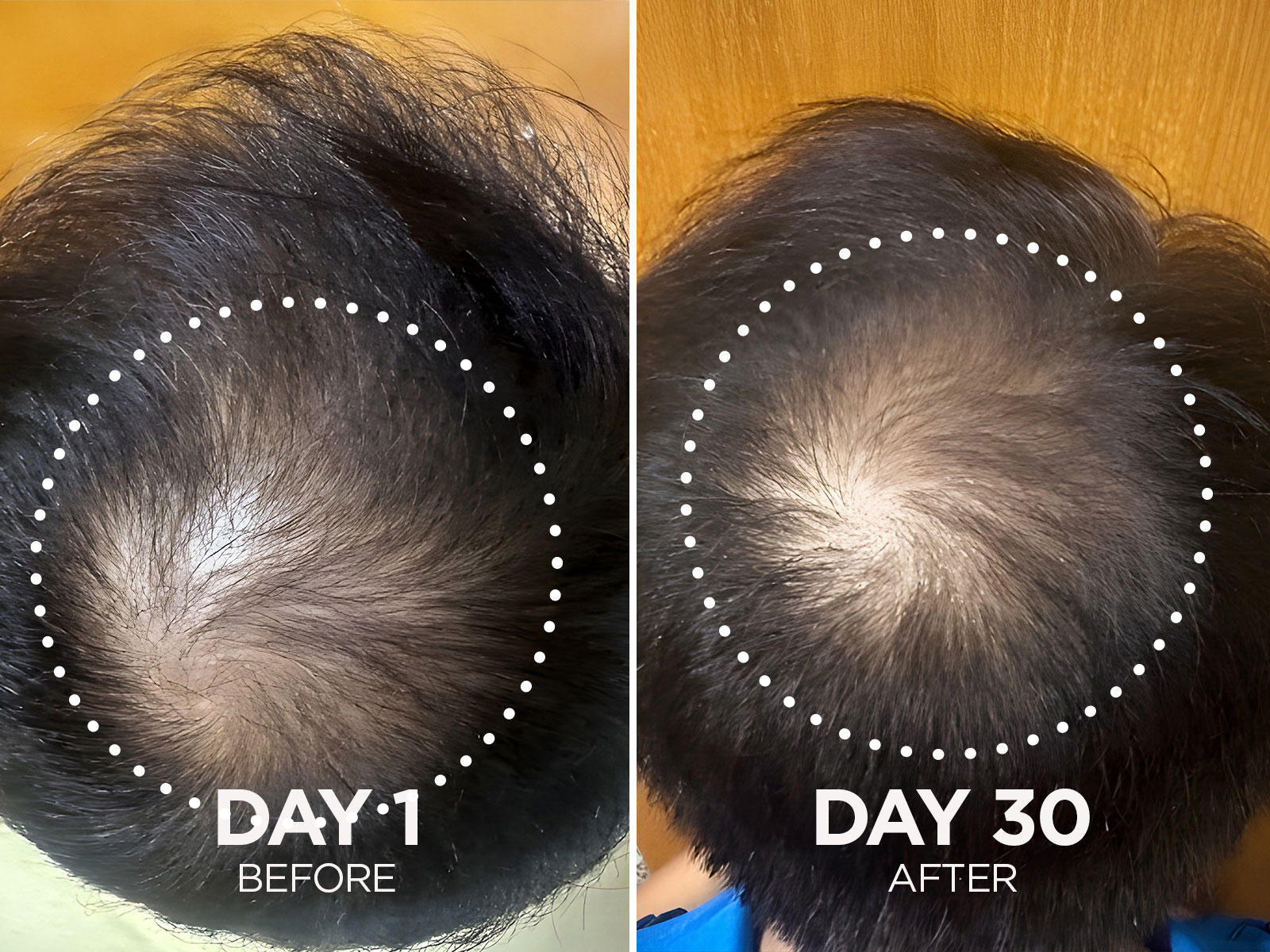 image of man head after using Fixx Hair Duo