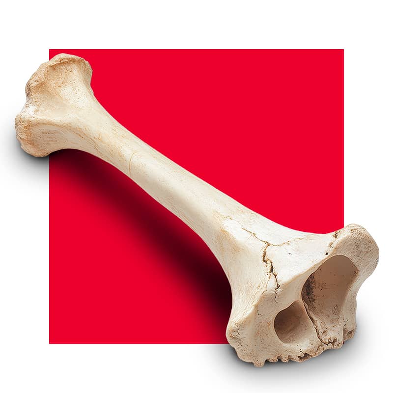 image of a bone