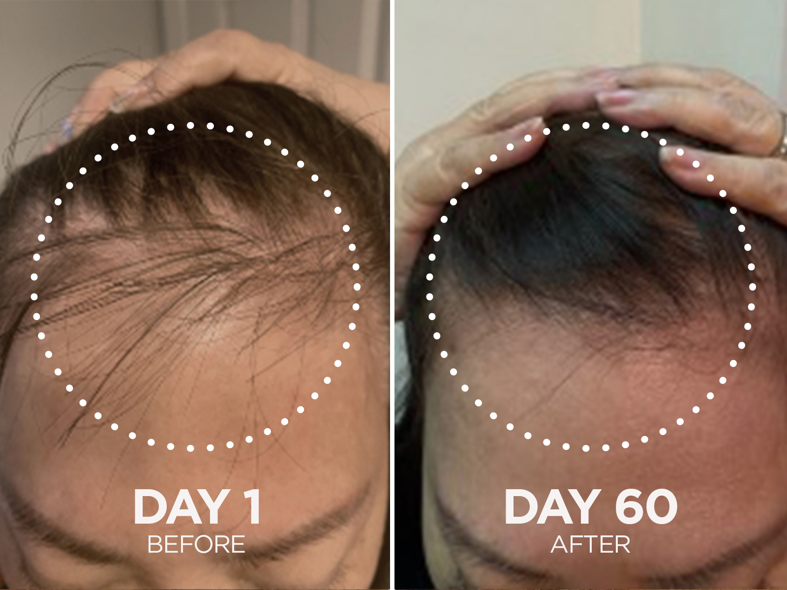 How Fixx Hair Growth Duo Benefits You