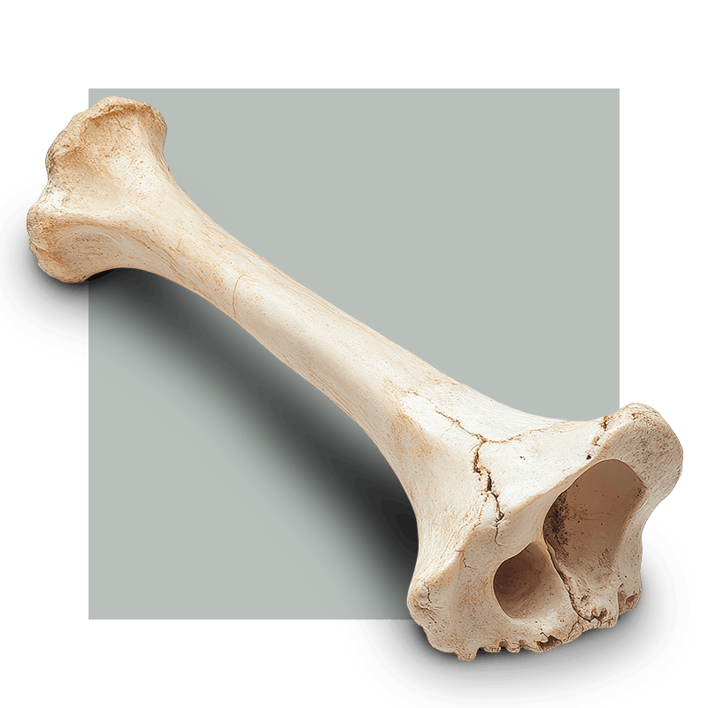 image of a bone