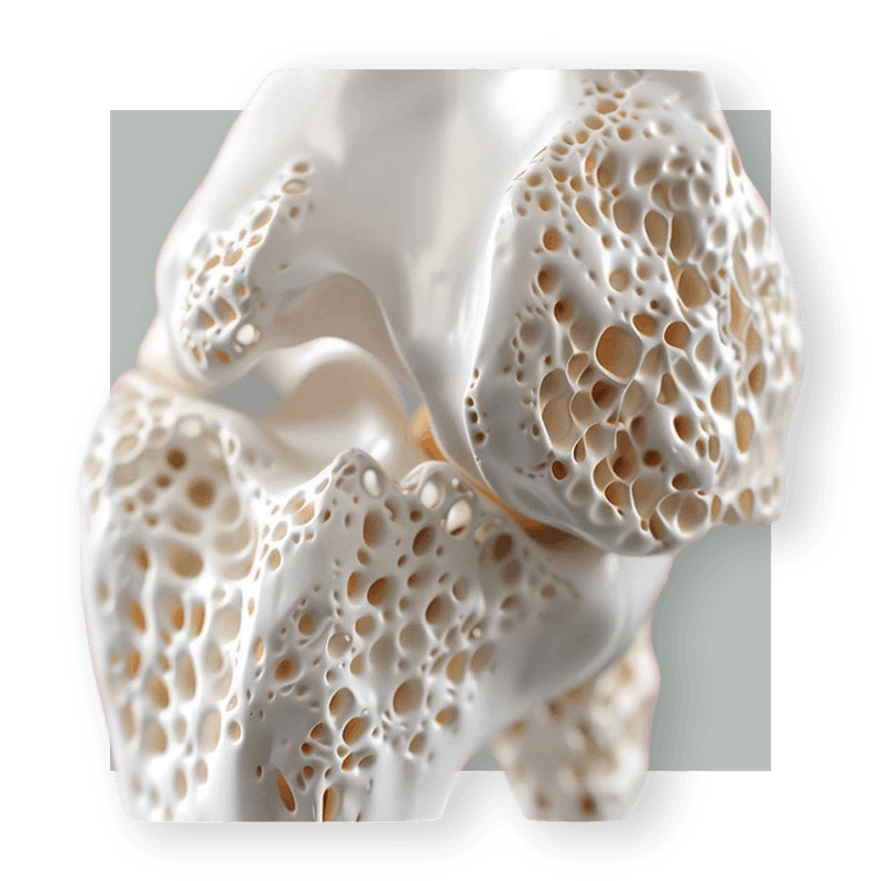 image of inside of bone
